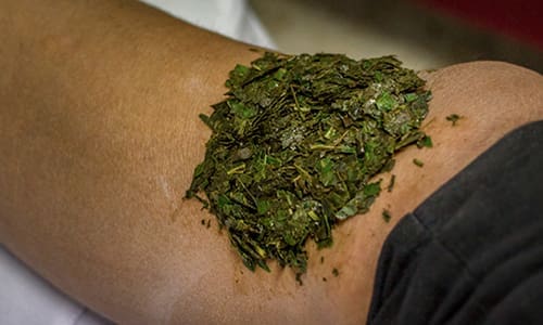 Applying usnea as an anti-bacterial cream