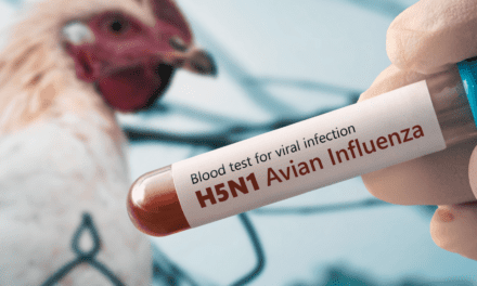 Can You Catch Bird Flu From Chickens? What No One’s Telling You